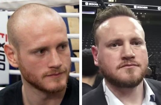 George Groves Hair Transplant Journey: A Knockout Transformation 1 George Groves Hair Transplant