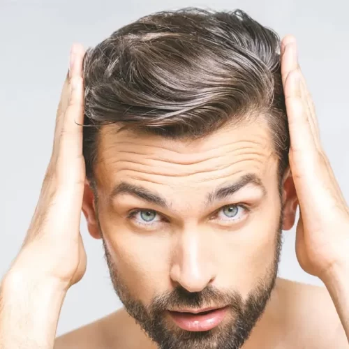 Hair Transplant Touch-Up: Perfecting Your Results