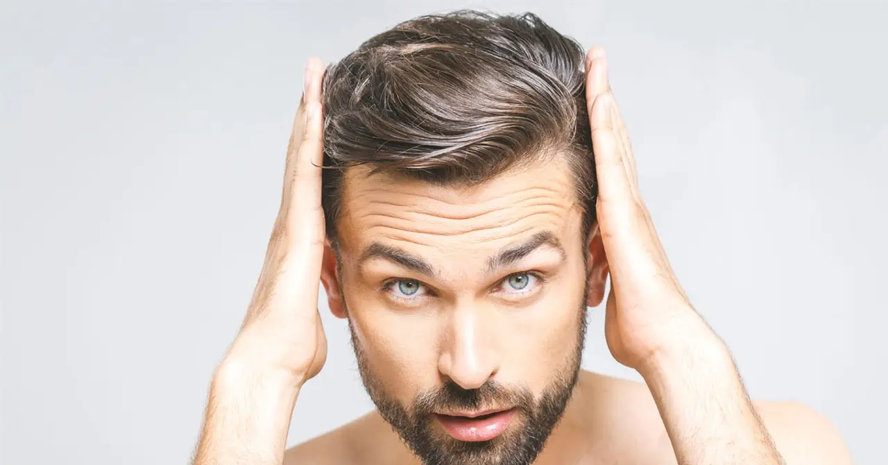 Hair Transplant Touch-Up: Perfecting Your Results 1 Hair Transplant Touch-Up: Perfecting Your Results