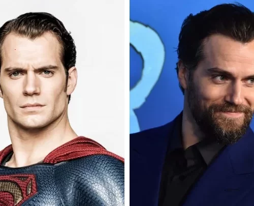 Henry Cavill Hair Transplant Speculation: Fact or Fiction?