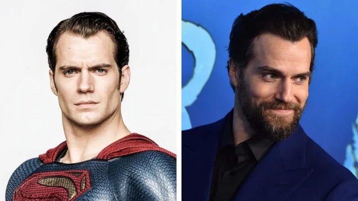 Henry Cavill Hair Transplant Speculation: Fact or Fiction? 1 Henry Cavill Hair Transplant Speculation: Fact or Fiction?