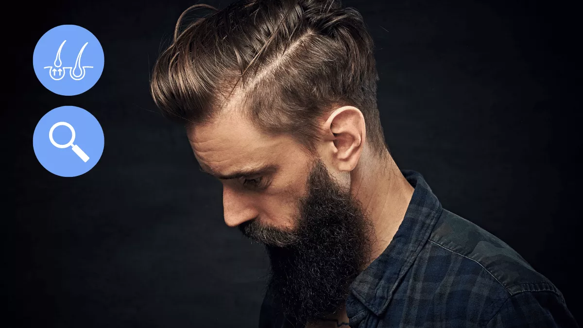 How to Hide Your Hair Transplant: Tips for a Discreet Recovery 1 How to Hide Your Hair Transplant: Tips for a Discreet Recovery