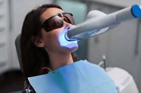 Is Laser Teeth Whitening Safe? What You Need to Know