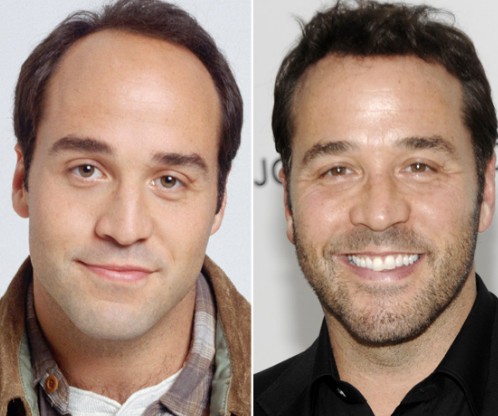 Jeremy Piven Hair Transplant: A Hollywood Transformation