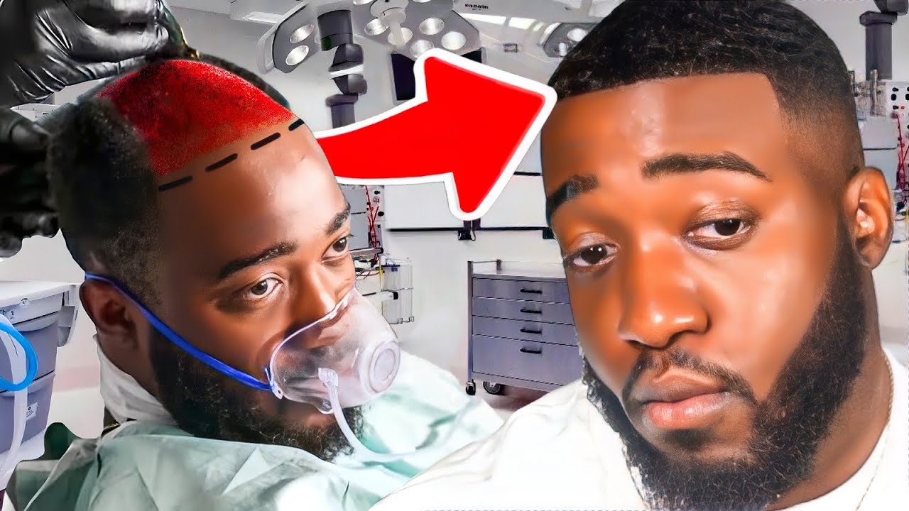 JiDion Hair Transplant: Confidence in Transformation 1 JiDion Hair Transplant: Confidence in Transformation