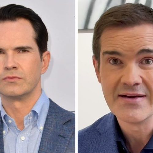 Jimmy Carr Hair Transplant: The Comedian’s Hair Transformation Journey