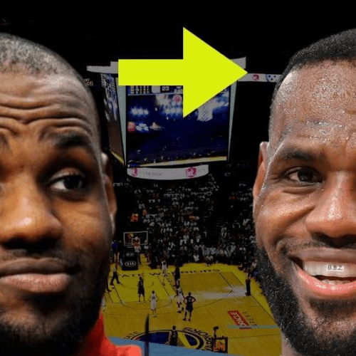 LeBron James Hair Transplant: Did the NBA Superstar Restore His Hairline?