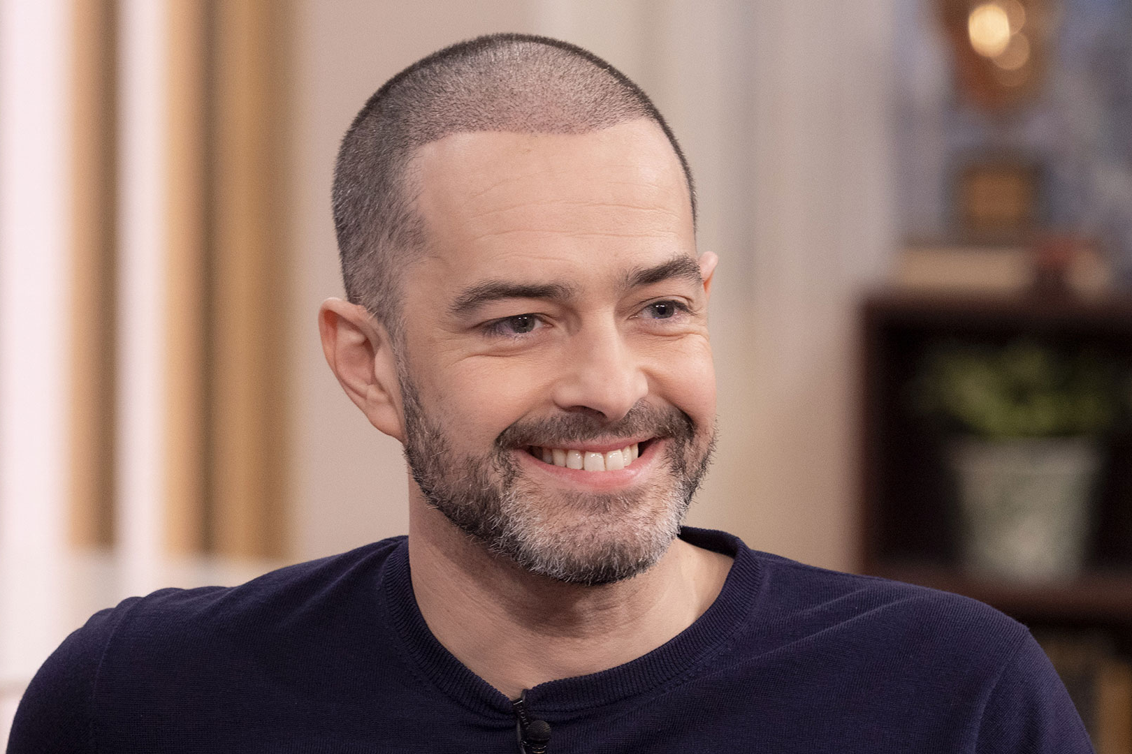 Lee Mead Hair Transplant Journey: Restoring Confidence and Style 1 Lee Mead Hair Transplant Journey: Restoring Confidence and Style