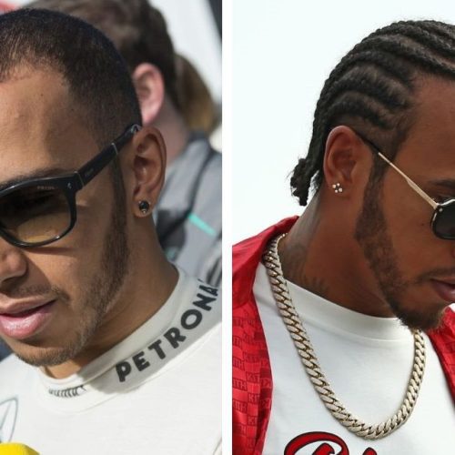 Lewis Hamilton Hair Transplant: Inspiring Confidence on and off the Track