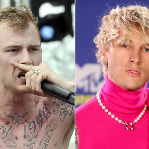 Machine Gun Kelly (MGK) Hair Transplant: The Truth Behind the Transformation