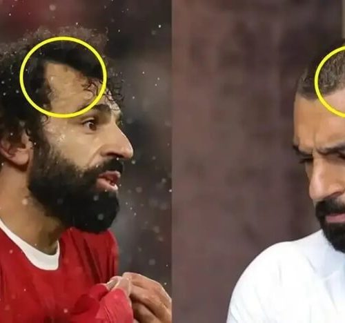 Mo Salah Hair Transplant: Did the Football Star Enhance His Iconic Hair?