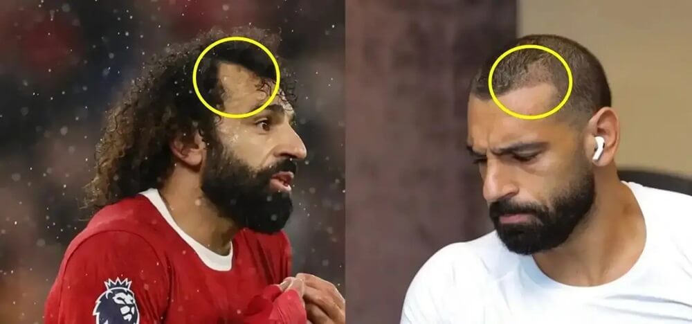 Mo Salah Hair Transplant: Did The Football Star Enhance His Iconic Hair?