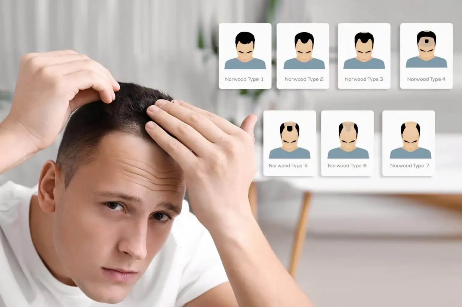 Hair Transplant for Norwood Scale 4: What to Expect 1 Hair Transplant for Norwood Scale 4: What to Expect