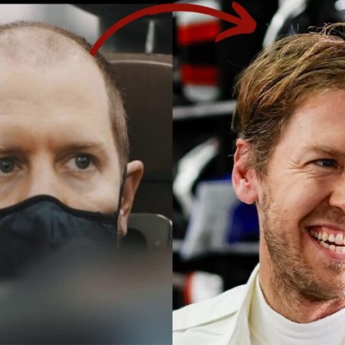 Sebastian Vettel Hair Transplant: Did the Formula 1 Legend Restore His Hairline?