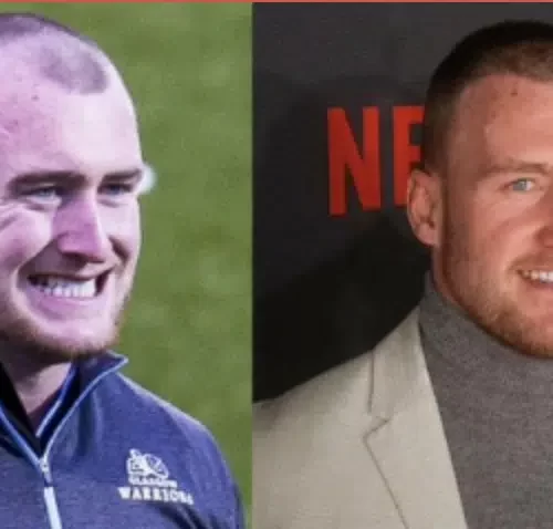 Stuart Hogg Hair Transplant: Did the Rugby Star Restore His Hairline?