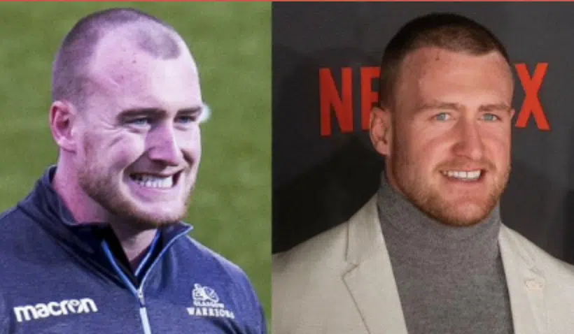 Stuart Hogg Hair Transplant: Did the Rugby Star Restore His Hairline? 1 Stuart Hogg Hair Transplant: Did the Rugby Star Restore His Hairline?