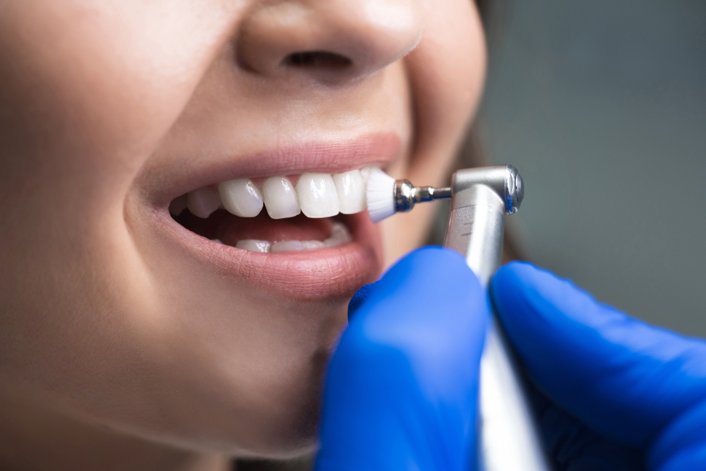 Teeth Whitening vs. Teeth Cleaning: What’s the Difference for a Whiter, Brighter Smile? 1 Teeth Whitening vs. Teeth Cleaning: What’s the Difference for a Whiter, Brighter Smile?