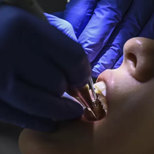 The Bright Side of Turkey Teeth and Dental Tourism in Turkey