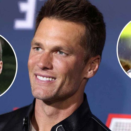 Tom Brady and Hair Transplants