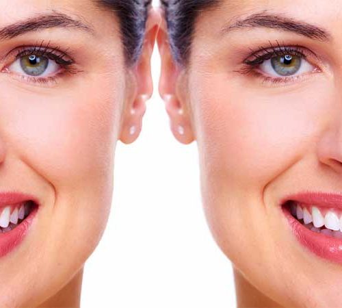 Tooth Reshaping: Procedure, Benefits, Risks, and Cost