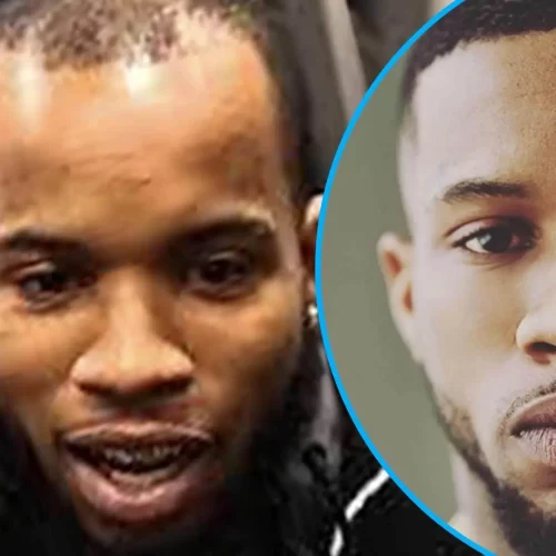 Tory Lanez Hair Transplant