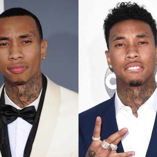 Tyga Hair Transplant: A Journey to Restoring Confidence and Style