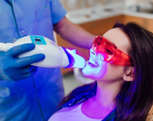 Zoom Teeth Whitening: Benefits, Process & Cost in Turkey