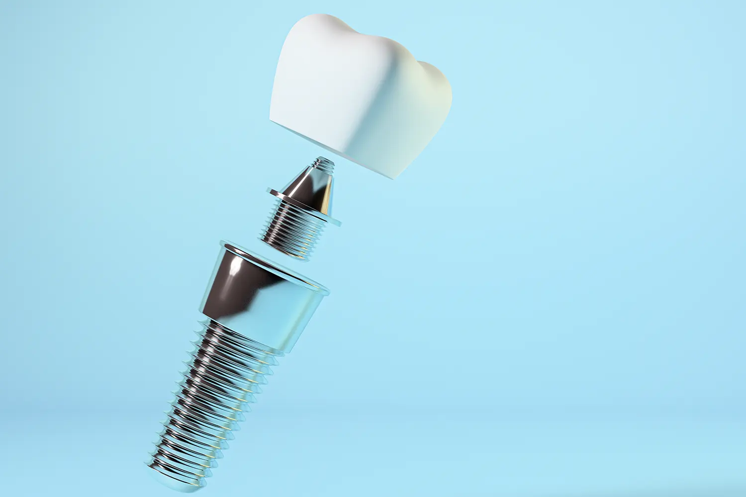 Dental Posts Explained: Types, Procedure, and Benefits 1 Dental Posts Explained: Types, Procedure, and Benefits