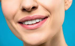 Do Teeth Whitening Kits Really Work? A Comprehensive Guide 1 Do Teeth Whitening Kits Really Work? A Comprehensive Guide