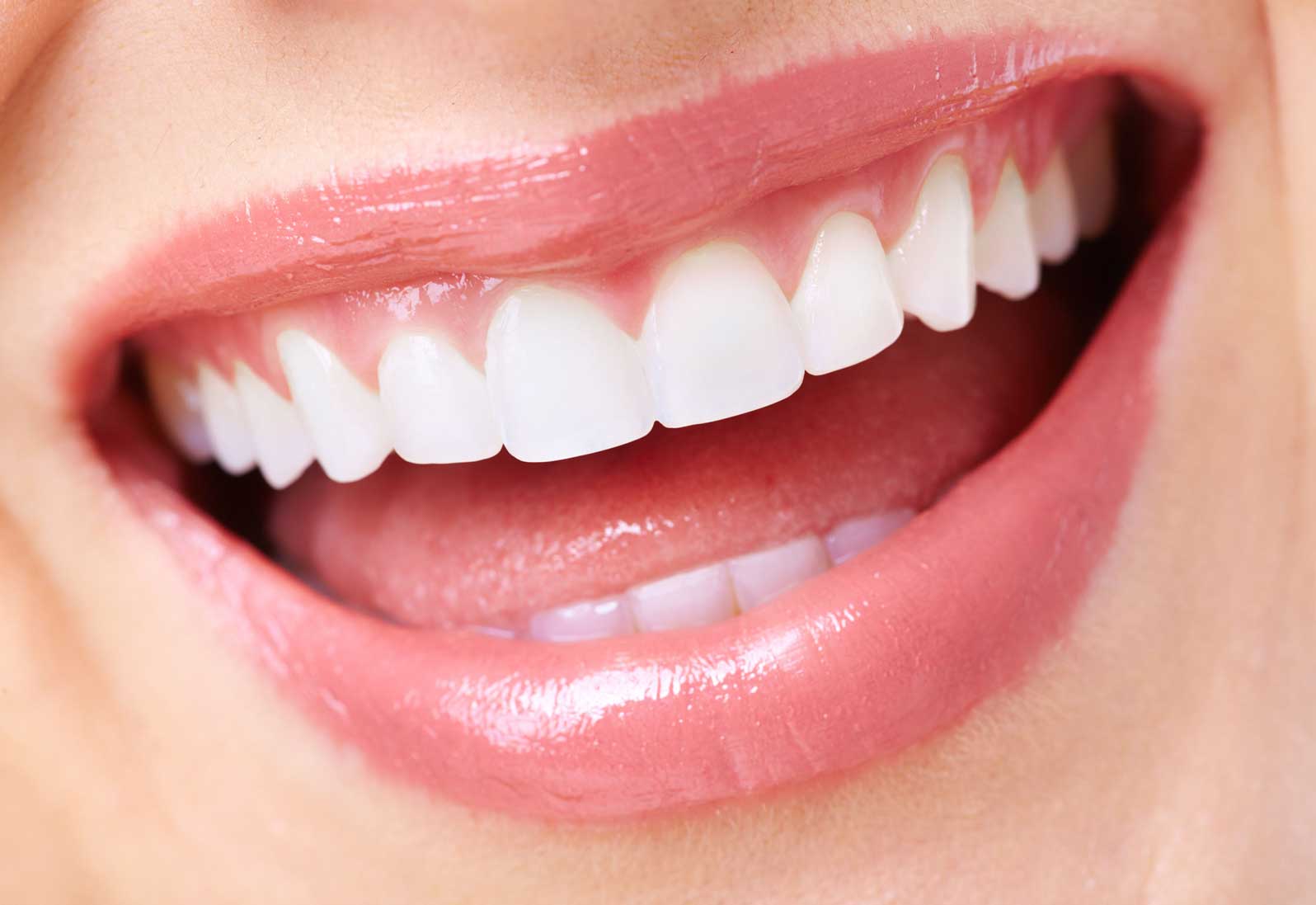 Everything You Need to Know About Lumineers Teeth 1 Everything You Need to Know About Lumineers Teeth