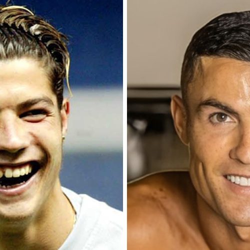 Get a Hollywood Smile Like Cristiano Ronaldo: The Cosmetic Treatments You Need