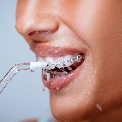 How to Use a Water Flosser (aka Waterpik): A Complete Guide