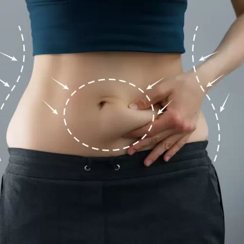 Preparing for a Tummy Tuck (Abdominoplasty Surgery) Physically and Mentally