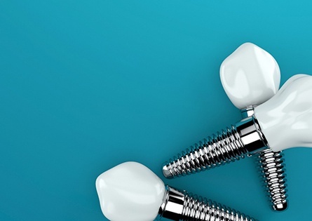 The Best Dental Implant Brands in Turkey