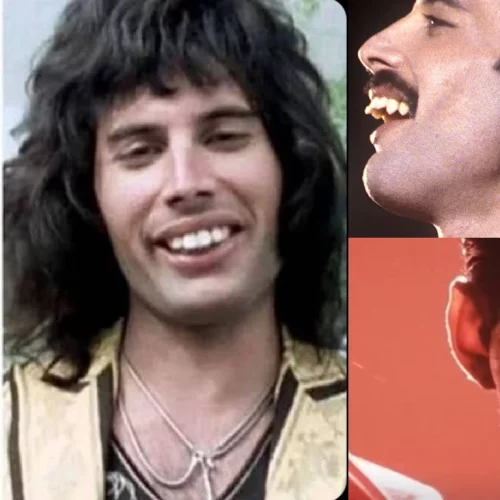 The Story Behind Freddie Mercury’s Teeth: A Unique Smile for a Legendary Voice