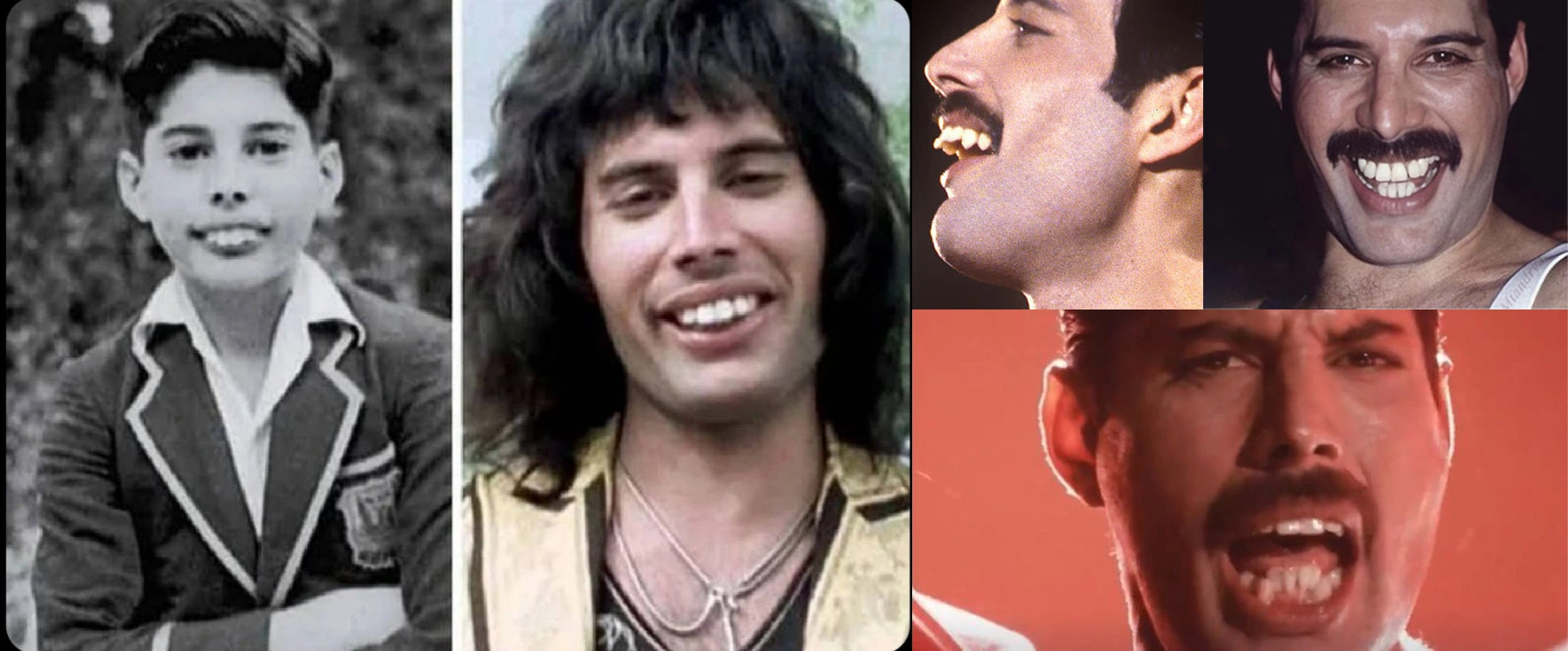 The Story Behind Freddie Mercury’s Teeth: A Unique Smile for a Legendary Voice 1 The Story Behind Freddie Mercury’s Teeth: A Unique Smile for a Legendary Voice