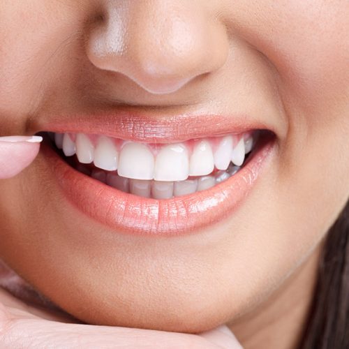 Top 5 Smile Makeover Procedures in Cosmetic Dentistry