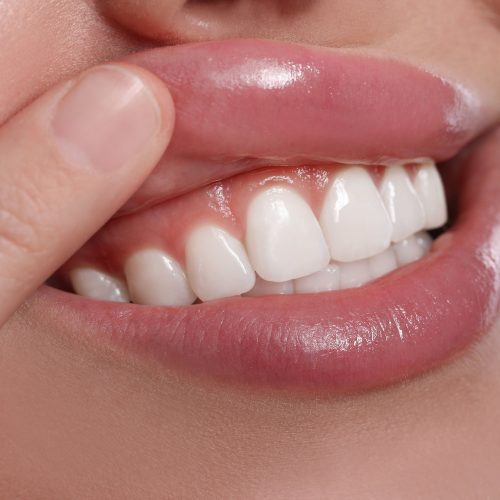 Understanding Inflamed Gums: Symptoms, Causes, and Effective Treatments