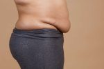 Understanding The 5 Grades Of Apron Belly