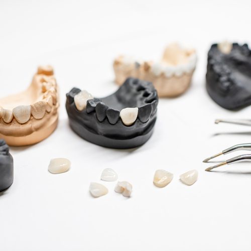 Understanding the Risks and Dangers of Dental Crowns: What You Need to Know